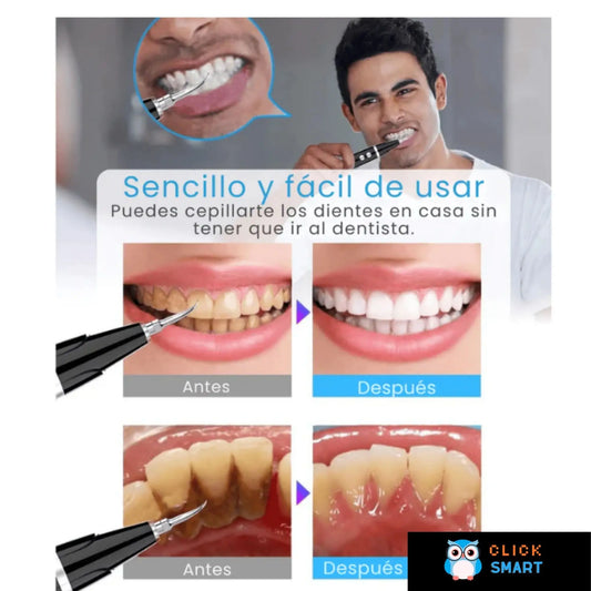 Kit Ultrasónico UltraClean™